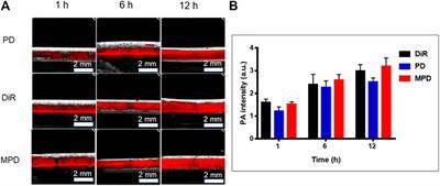 A Novel Biomimetic Nanoprobe as a Photoacoustic Contrast Agent